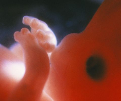 Mani e piedi di un feto alla 10a settimana di gravidanza