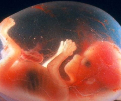 Fœtus dans la poche amniotique