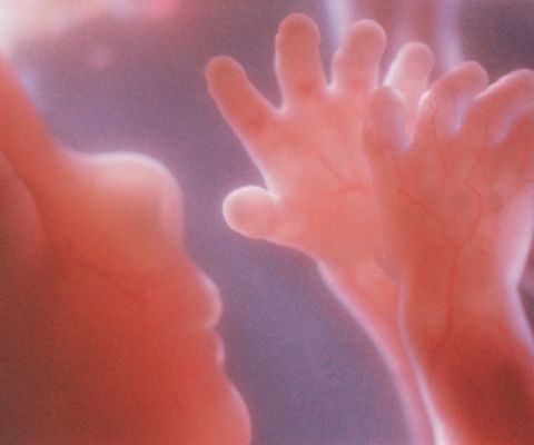 Gesicht und Hände des Kindes in der 18. Schwangerschaftswoche
