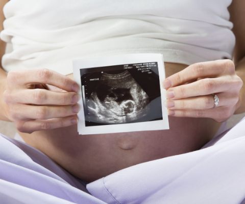 Schwangere zeigt Ultraschallfoto