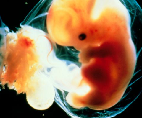 Embryo in Fruchtblase