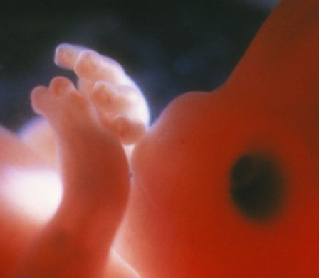 Les mains et la tête d’un fœtus à la 10e semaine de grossesse